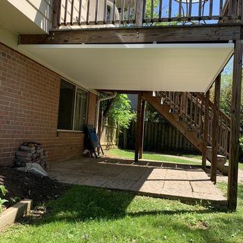Backyard Builders Deck Pergola, Zip Up Under Deck Ceiling Cost
